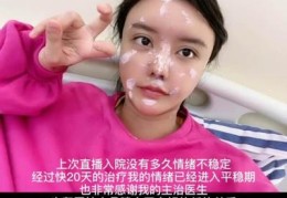 直播卖膏药技巧,膏药可以在直播间卖吗